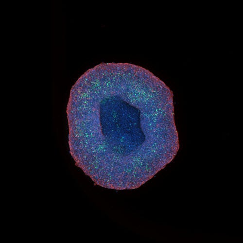 10배 확대로 얻은 HepG2 스페로이드 (Spheroid)
